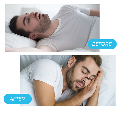 UBA™-Sports Nasal Dilator